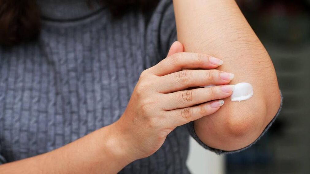 psoriasis on the elbows treatment