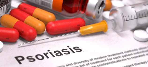 anti-psoriasis drugs