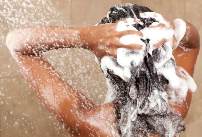 Shampoos from psoriasis